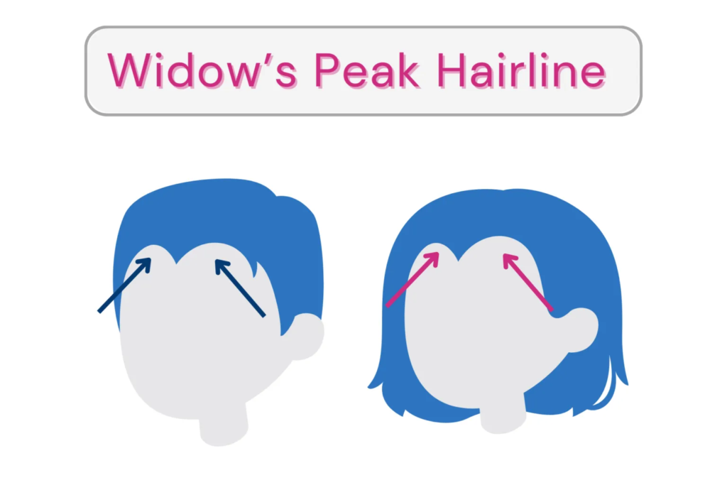 what causes a widow's peak
