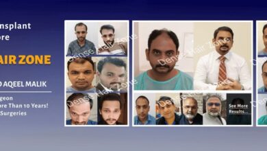 Hair Transplant in Lahore