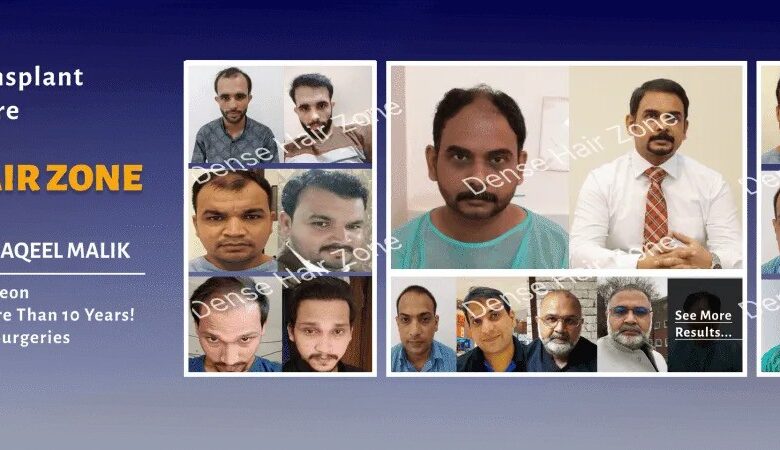 Hair Transplant in Lahore