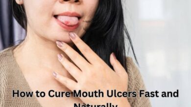 Mouth Ulcers