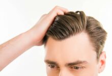 what causes a widow's peak