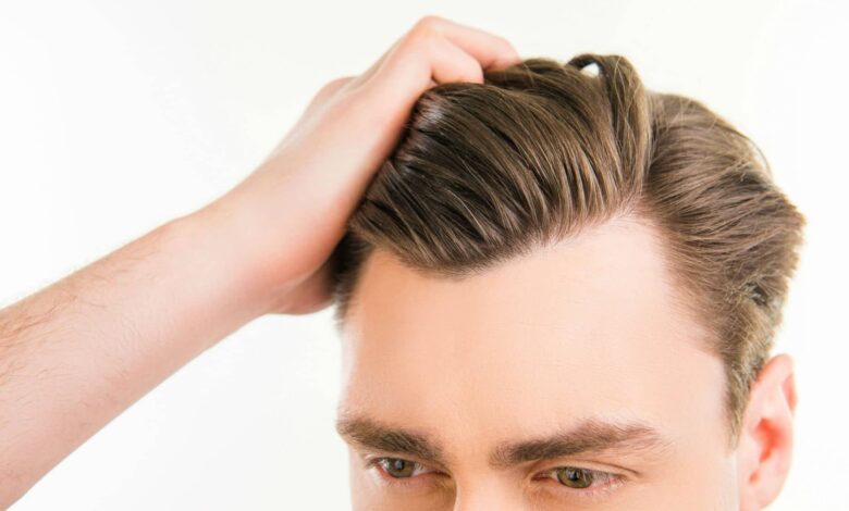 what causes a widow's peak